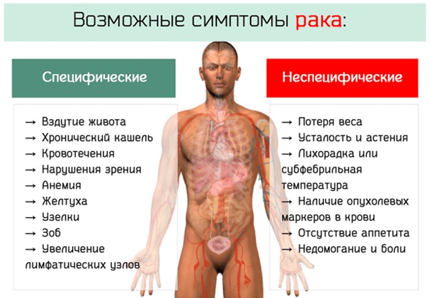 10 самых распространенных симптомов рака